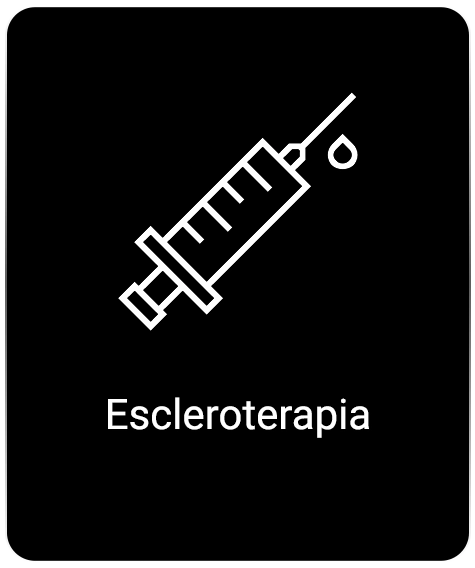 escleroterapia